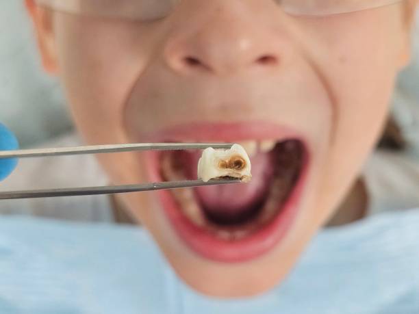 Best Emergency Cosmetic Dentistry (e.g., broken veneers) in USA